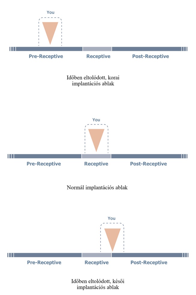 ERA teszt – az implantációs (beágyazódási) ablak: korai, normál és késői receptivitás