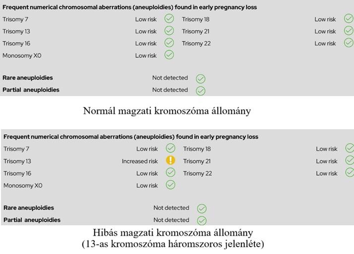 SABscan teszt eredménye – normál magzati kromoszómakészlet és 13-as triszómia (13-as kromoszóma háromszoros jelenléte) összehasonlítása