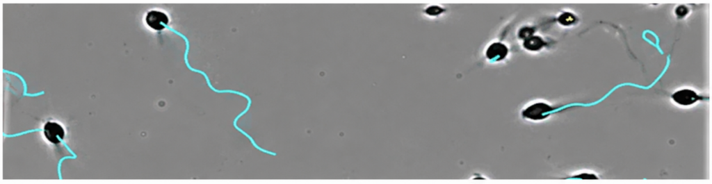 AI spermatogram vizsgálat – spermium mozgékonyság elemzése WHO szerint