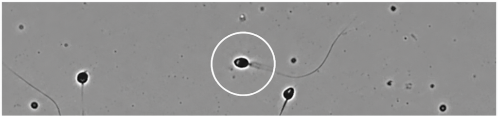 AI spermatogram vizsgálat – spermium morfológia (alaktan) elemzése